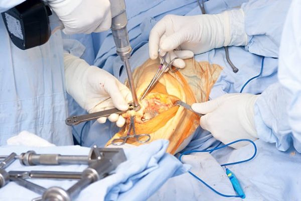 Knee Surgery Explained: Options, Outcomes, and Recovery Tips Knee Surgery Explained: Options, Outcomes, and Recovery Tips